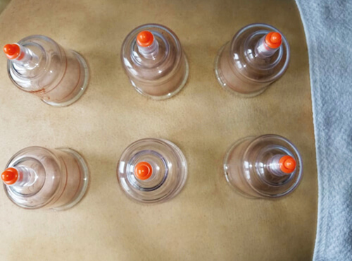 Mary – Medicina Oriental - Foto 3